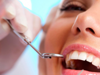 Зубы для имплантации будут выращивать в лаборатории